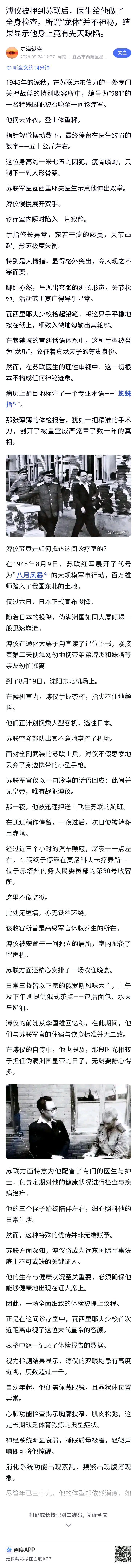 溥仪被押到苏联后，医生给他做了全身检查。所谓“龙体”并不神秘，结果显示他身上竟有先天缺陷。