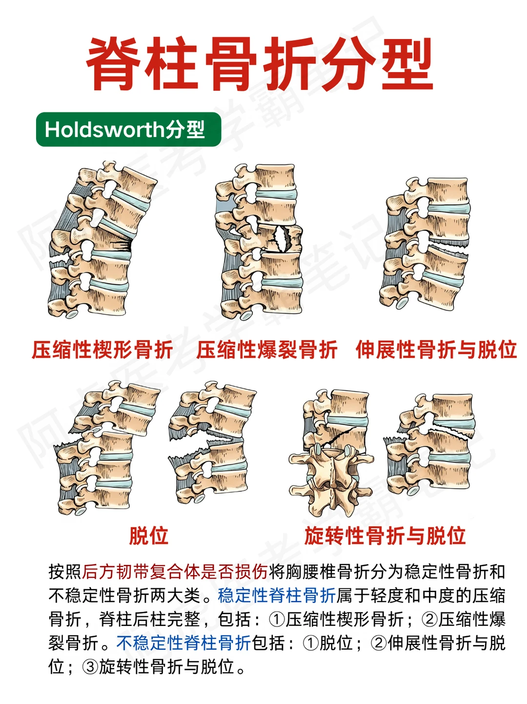 阿虎医考笔记📒脊柱骨折分型❤️