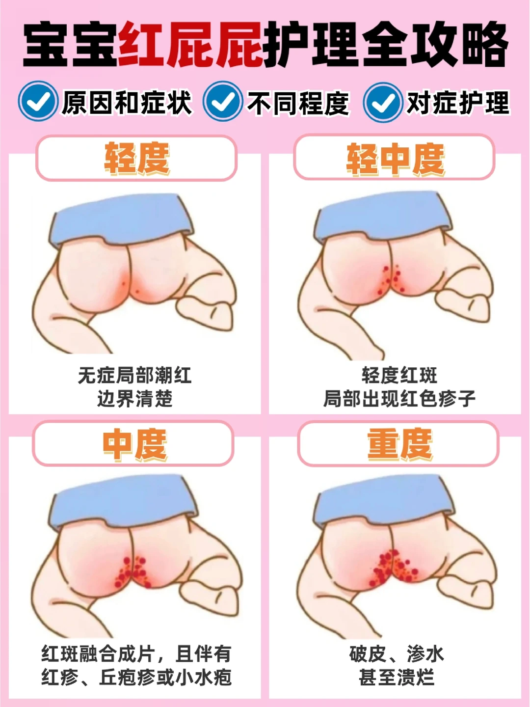 宝宝红屁屁护理全攻略，新手妈妈避坑必看！