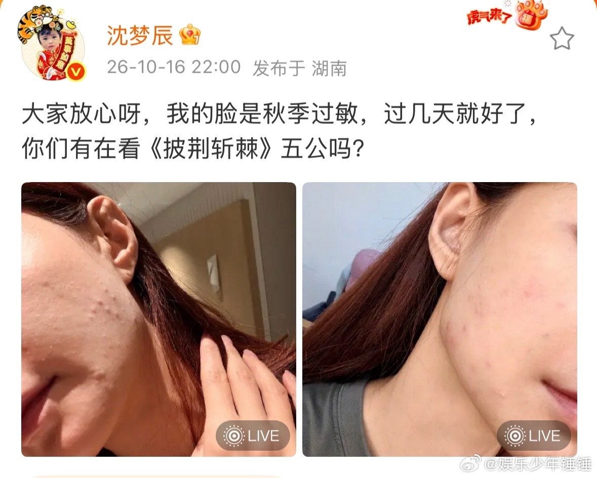 #沈梦辰回应脸过敏##沈梦辰回应过敏# 沈梦辰回应脸过敏，晒出的照片里脸颊红红的，看着就难受。姐姐还宣传披荆斩棘五公，太敬业了。 ​