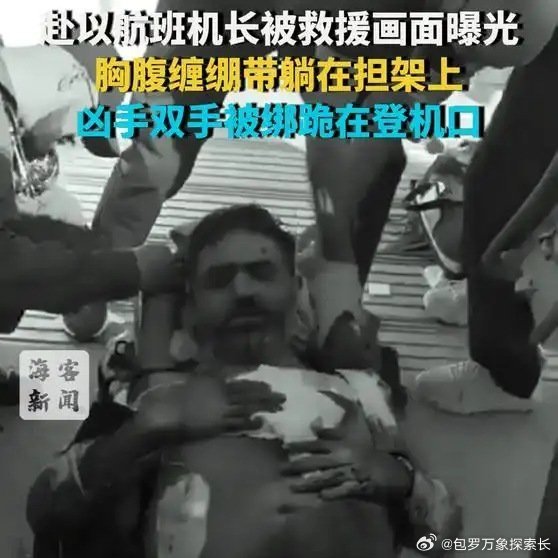 《【🔥百度热搜】赴以航班机长被救援画面曝光：胸腹缠绷带躺在担架上 凶手双手被绑跪在登机口》赴以航班机长被救援画面曝光：胸腹缠绷带躺在担架上 凶手双手被绑跪在登机口 有惊无险，上百乘客命悬一线 ​