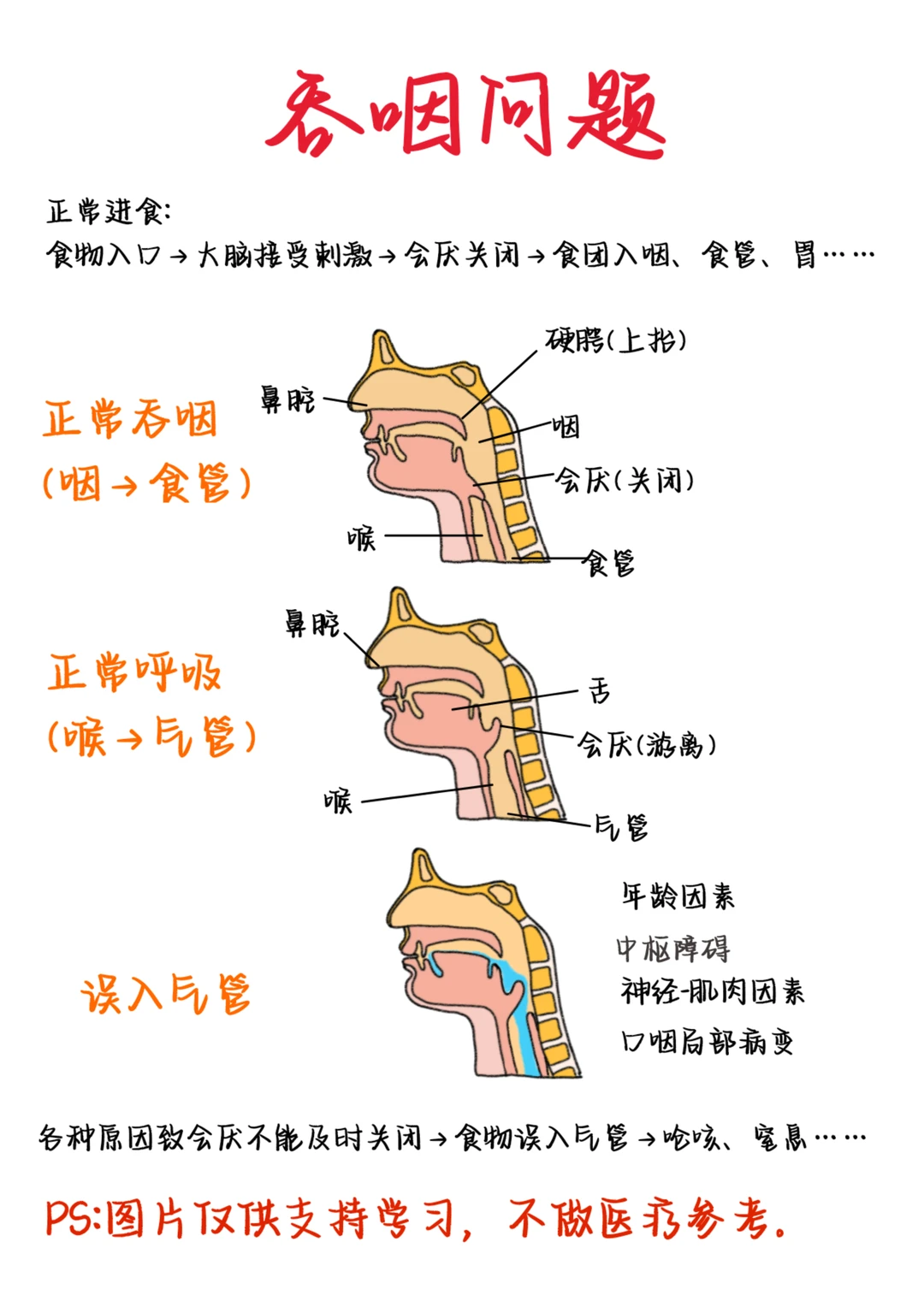 医学生笔记——吞咽问题