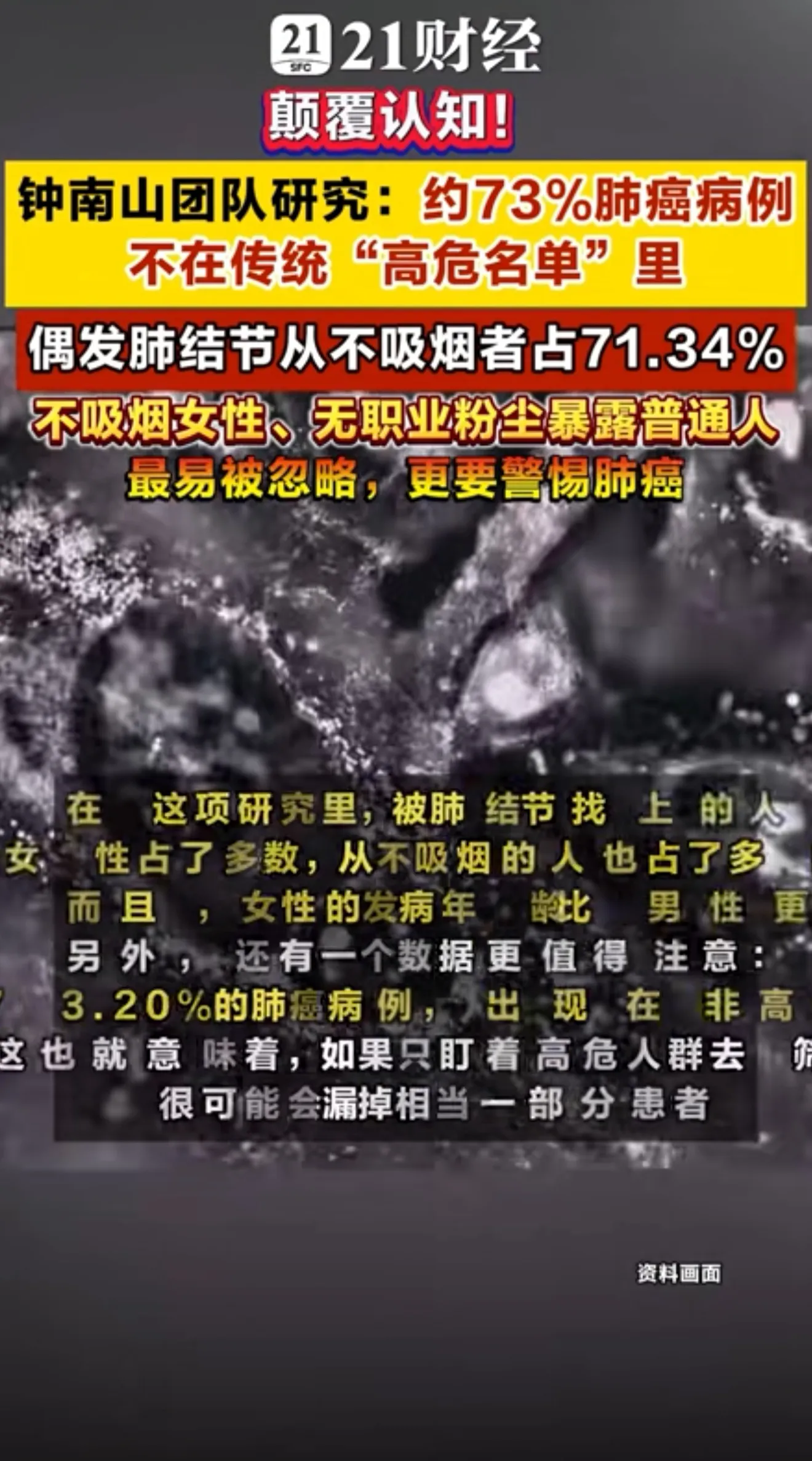 钟南山团队新研究：71%肺结节患者，竟然不吸烟
很多人以为，肺结节、肺癌只会找上抽烟的人。钟南山团队一项大样本研究，打破了大家固有的认知。
2026年8月，研究发表在国际期刊。团队调研全国16个省份、23家医院，一万多名偶发肺结节人群，持续随访2到3年。结果显示，71.34%的肺结节患者从不吸烟，7