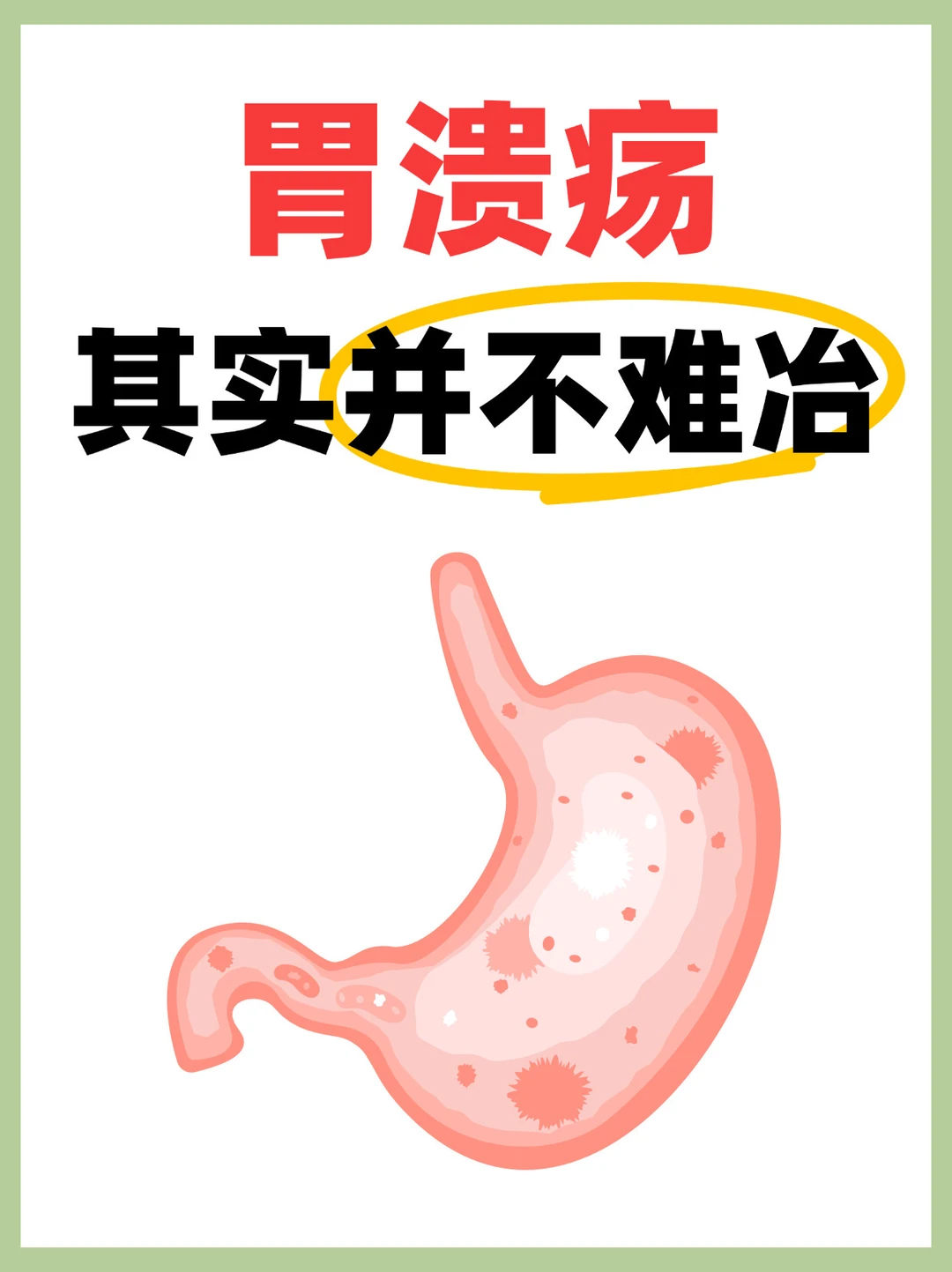 胃溃疡真的一点儿也不难冶
