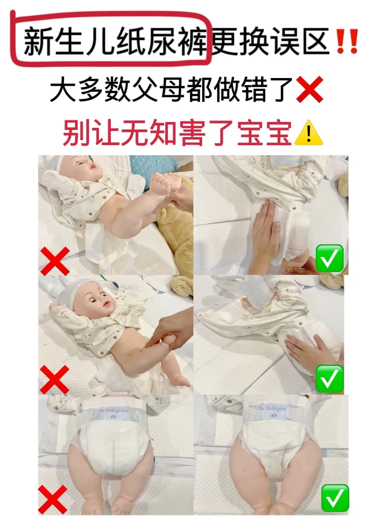 换纸尿裤千万要注意⚠️大多数父母都做错了‼️