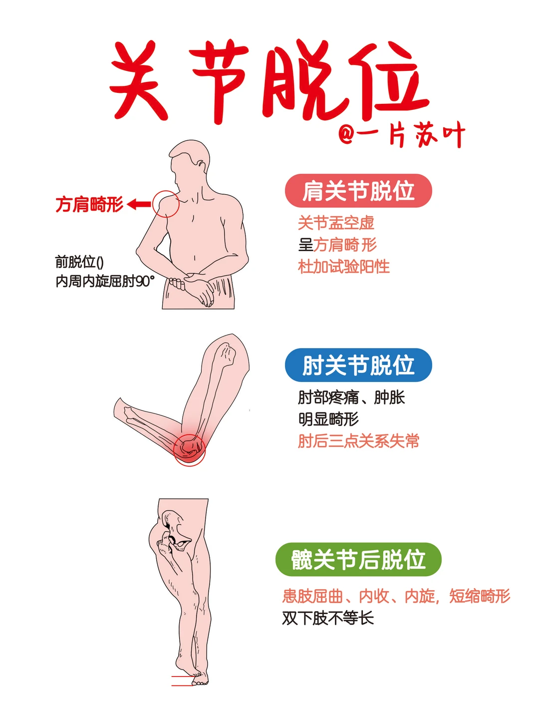 手写笔记✅关节脱节📕外科护理学‼️