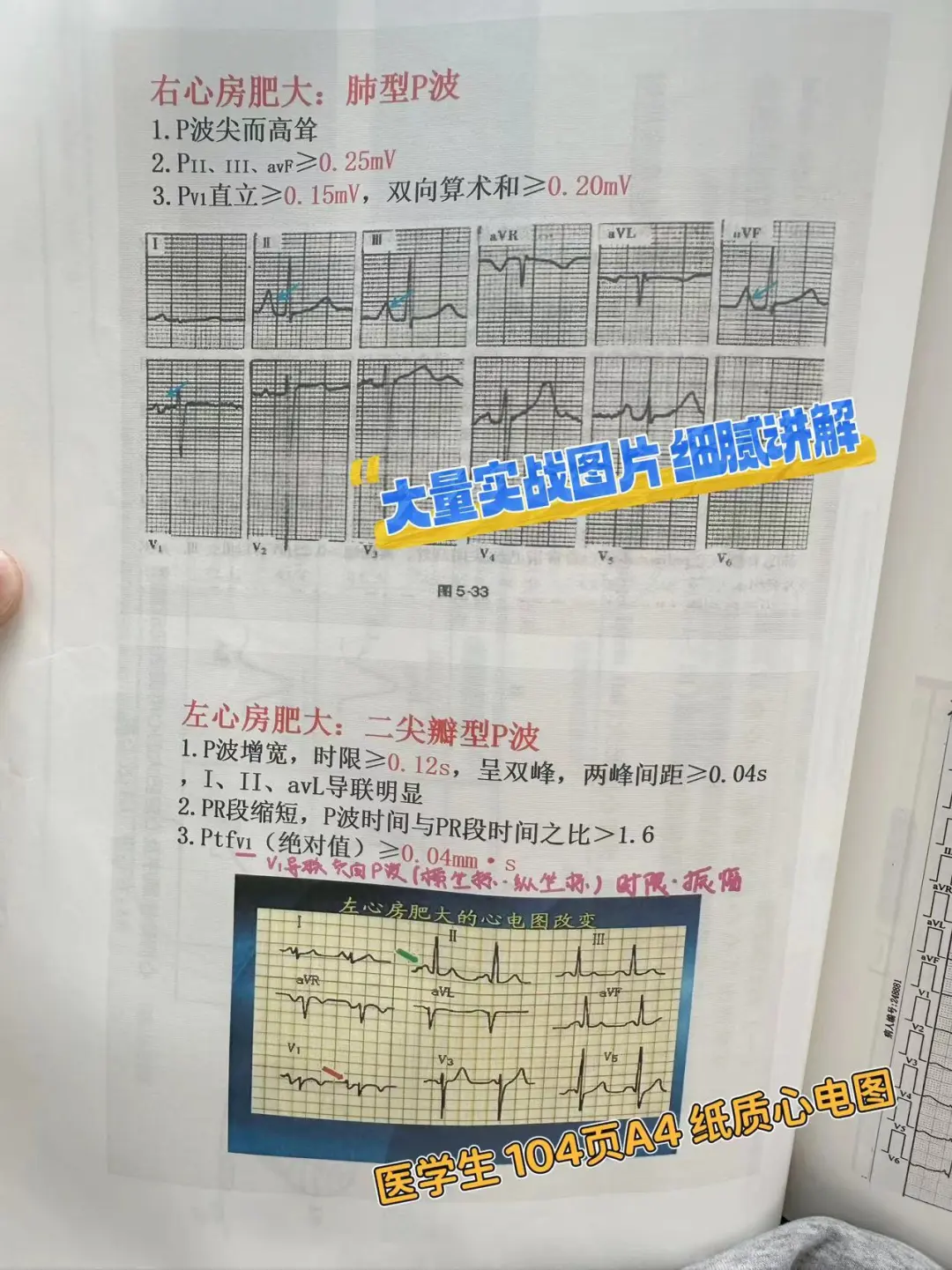 医学生规培笔记心电图