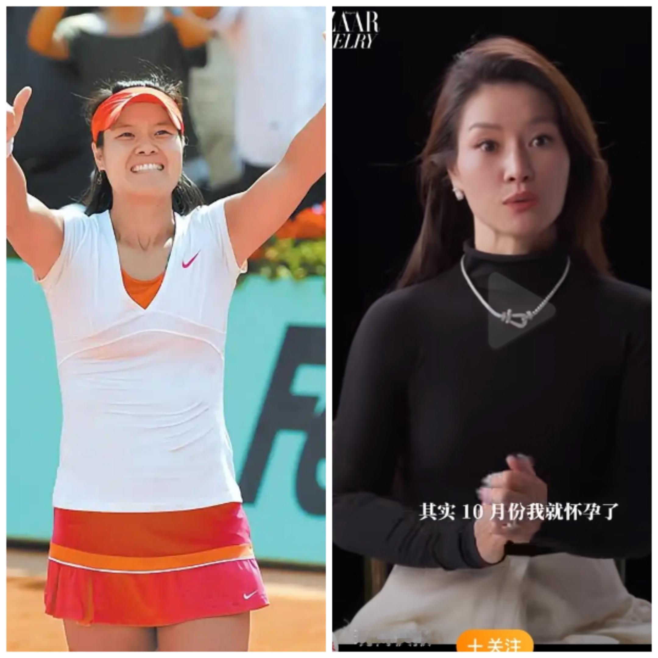 李娜这变化也太大了吧，退役前和退役后简直就是判若两人，看来有钱人想变美还是相当容易的
 
李娜退役那年是二零一四年，三十一岁，膝盖动了四次手术，浑身上下没几处好地方。打球那会儿她常年素面朝天，晒得黝黑，胳膊上全是肌肉线条，脸上写满紧绷和疲惫。没人夸她漂亮，大家只说她能打。
 
退役之后她像换了个人。