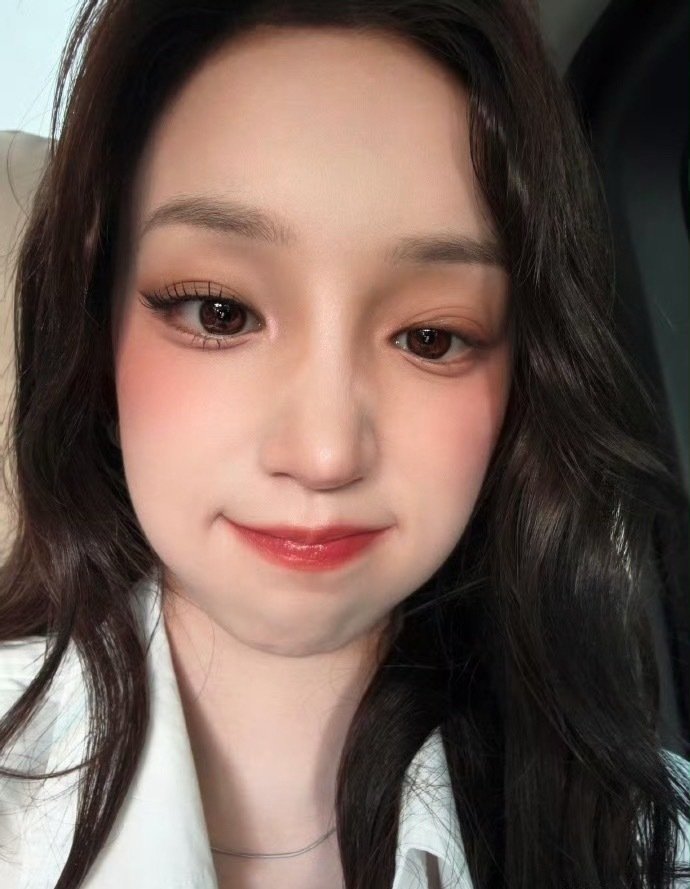 #宋雨琦肿成蜜蜂小狗#我的天 好可爱 ​
