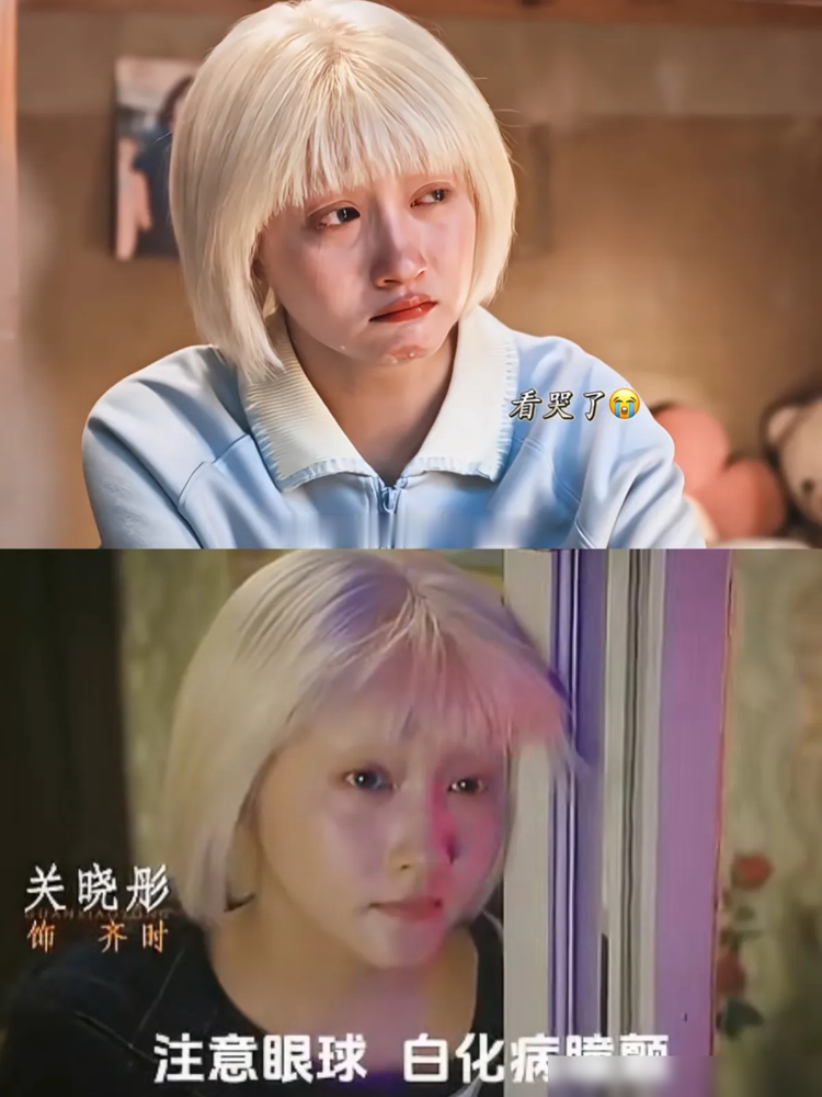 关晓彤这次把白化病演绝了，眼球微颤、畏光眯眼、连听人说话都侧着耳朵。
《生逢其时》央一播到一半，弹幕全在问她是不是真得了病，其实就是死磕细节磕出来的。跟王子奇站一块，她那种怕光又渴望靠近的劲，一句台词没有，比哭还扎人。
剧里哭戏也收着演，眼泪含在眼眶里打转，就是不掉下来。对比当年《好先生》拿白玉