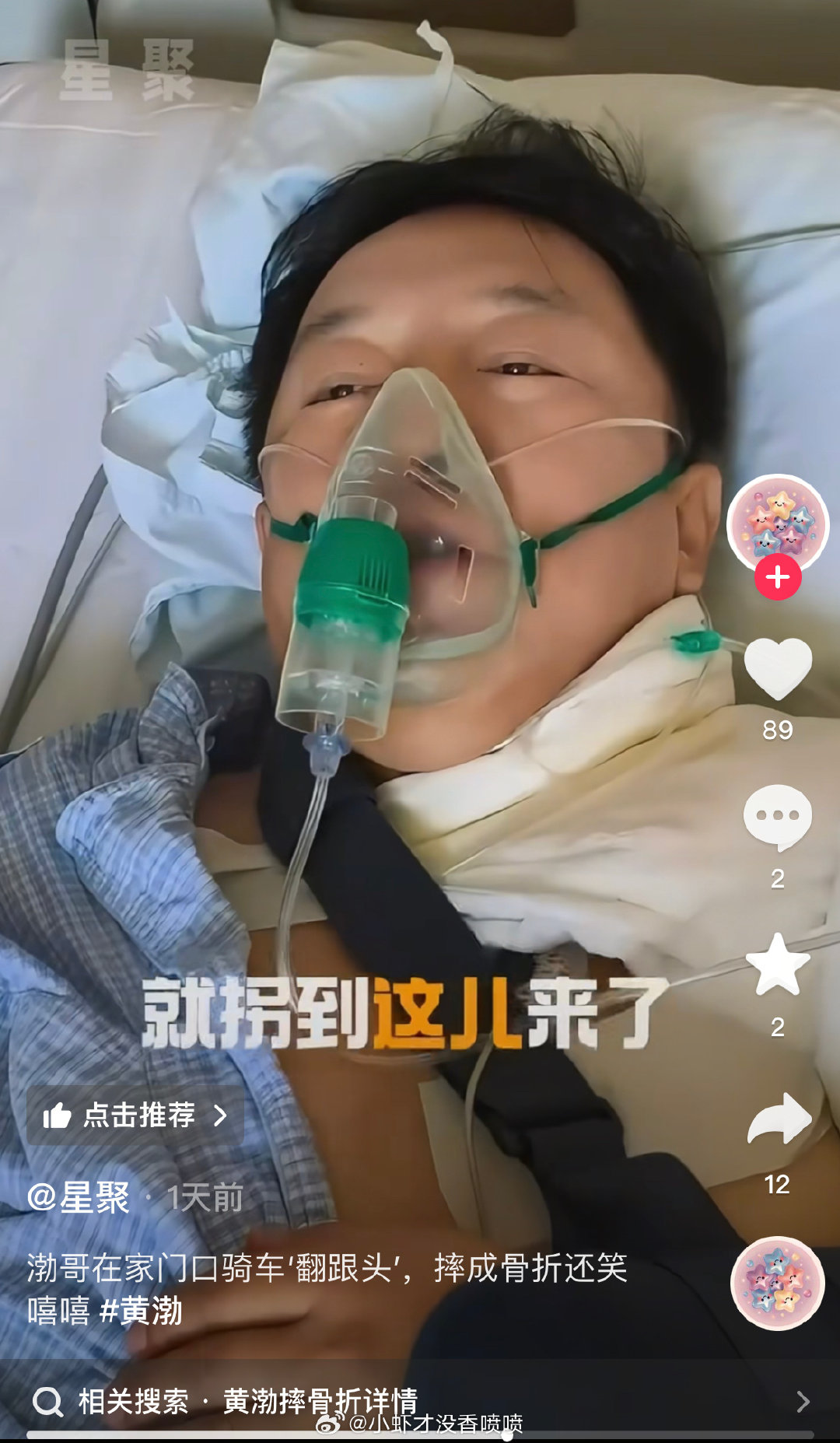#黄渤骨折##黄渤骑车摔成锁骨骨折# 
黄渤前两天骑行手臂骨折
这两天锁骨摔骨折了[哆啦A梦害怕] ​