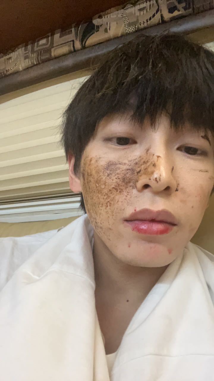 #彭昱畅[超话]#  pyc#彭昱畅# pyc#向全世界安利彭昱畅# 

我开始躲着所有也爱你的人 怕有人比我更会爱你

​