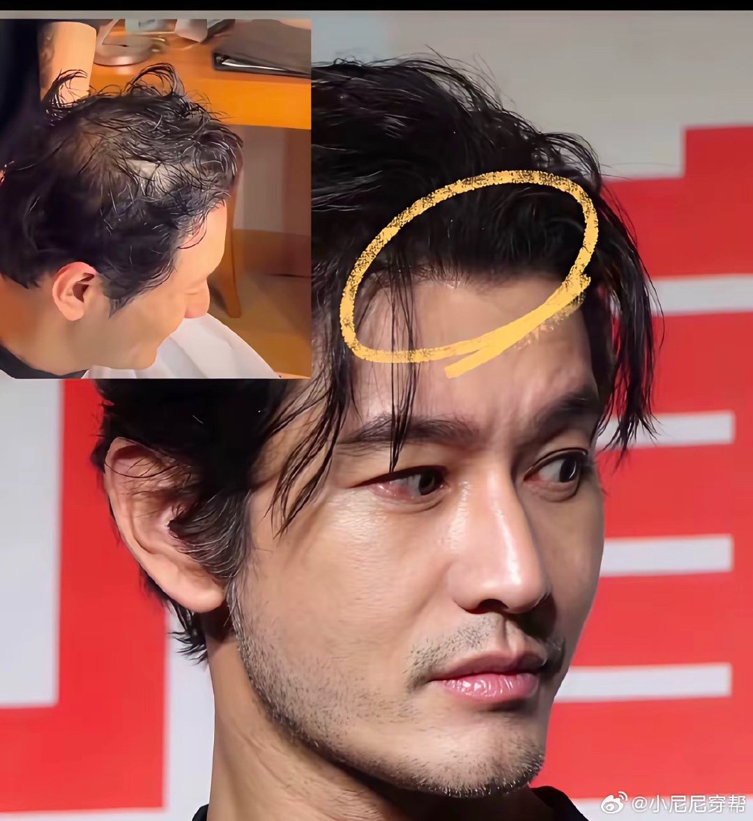 别的不服，就服黄晓明的发量！ ​