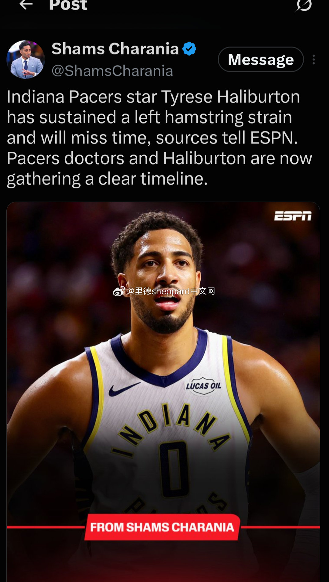 今年这是怎么了。。。伤病大爆发啊
#NBA[超话]##泰里斯·哈利伯顿# ​