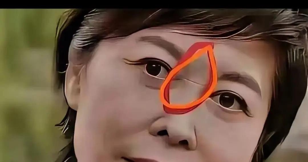 半夜三更心内科和皮肤科大夫连夜出来发声辟谣，硬是被一帮网上的“赛博神医”给逼出来的

谁能想到央视名嘴敬一丹就是因为露面时鼻梁上多了一道浅浅的褶子，居然能在评论区里被集体“确诊”了心脏病

这帮看客拿着高清图隔空望闻问切，说得有鼻子有眼，愣是把一道衰老留下的印子跟生死大病死死绑在一块儿

人家专业医