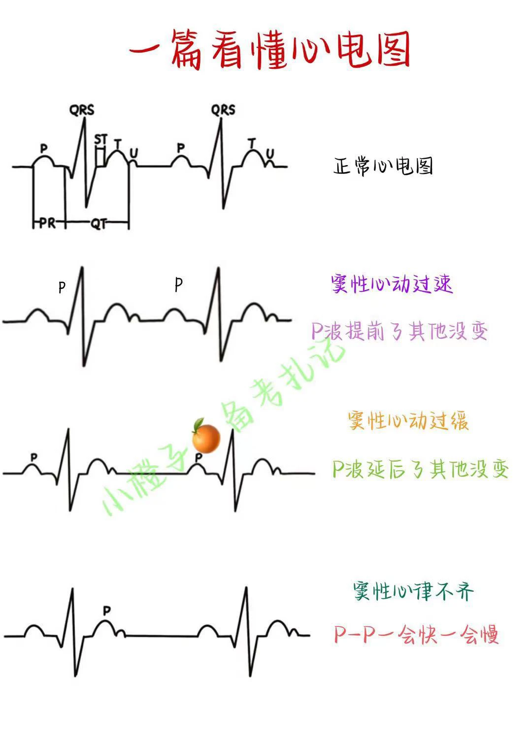 📖护师笔记｜一篇看懂心电图🔥