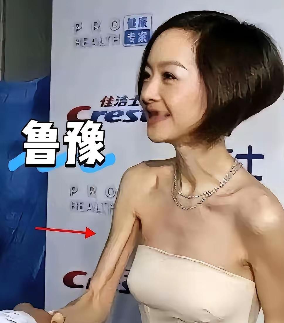 镜头把人拉宽十斤的残酷现实，正在把一批女明星逼成现实里的“纸片人”。
现实中要是瘦到前胸贴后背，走在街上大家可能觉得营养不良，可一塞进高清镜头里，居然正好。
金晨和吴谨言都是学舞蹈出来的，底子原本就轻，为了在特写里下颌线紧绷、看不出一点浮肿，经年累月在餐盘里数着米粒过日子。
刘雯要适配高定T台