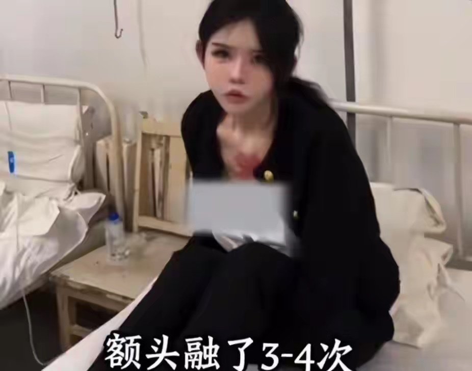女网红自曝整容后遗症，浑身长期散发腐烂味，睡觉都能把自己臭醒。 ​