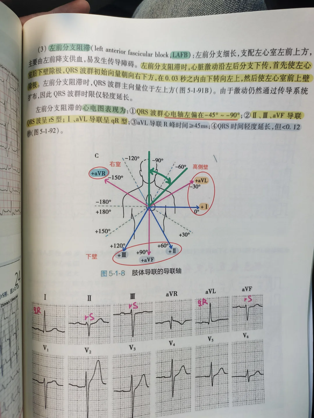 规培夜班医学生心电图