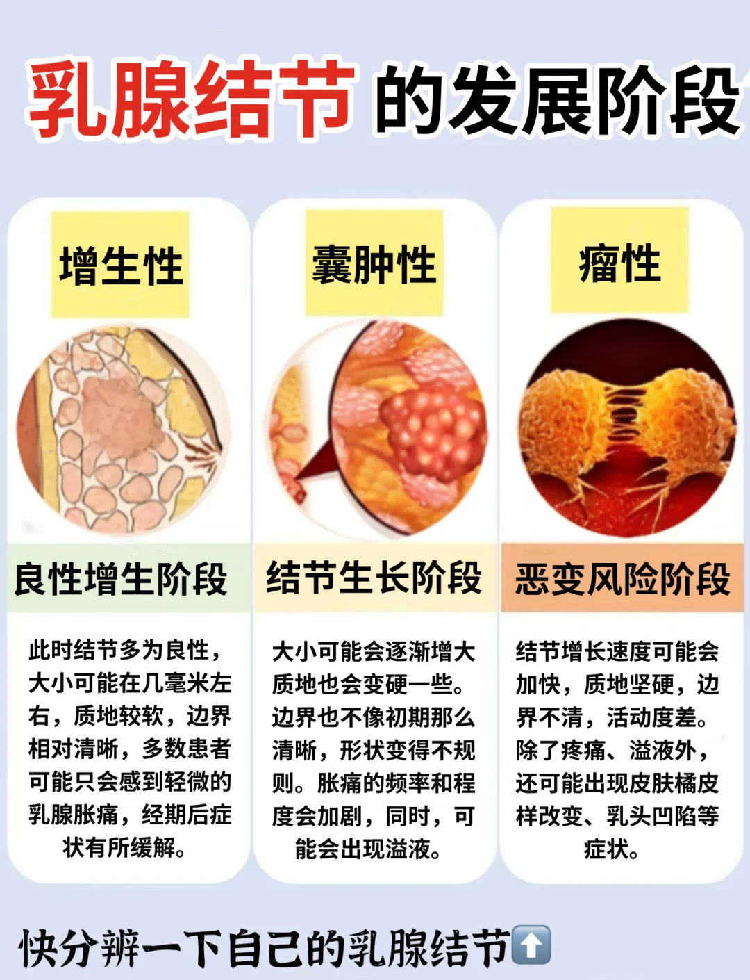 6毫米，豌豆大小，差点被两家医院漏掉。据媒体报道，北京王女士体检时查出乳腺微小结节，体检医生徐蕾特意叮嘱她复查时务必定点探查，还强调“如果医生说没找到，你一定告诉他位置，让他对着这个位置再扫几遍”。最终这枚病灶确诊为早期乳腺癌。
这件事真正值得讨论的，不是“结节有多可怕”，而是两层 ​