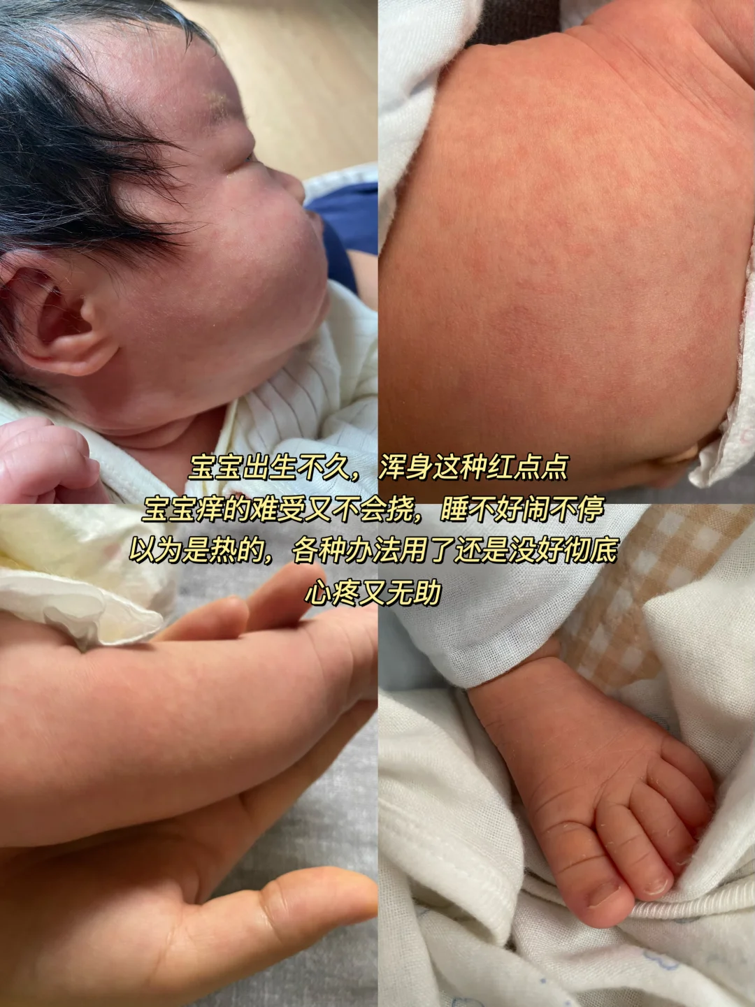 自查！宝宝D3可能会导致过敏！！！