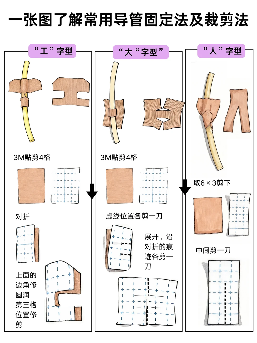 阿虎医考笔记：一文了解常用导管固定裁剪法