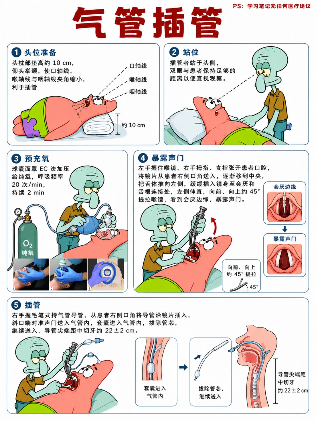 阿虎医考笔记📒气管插管详细步骤❤️