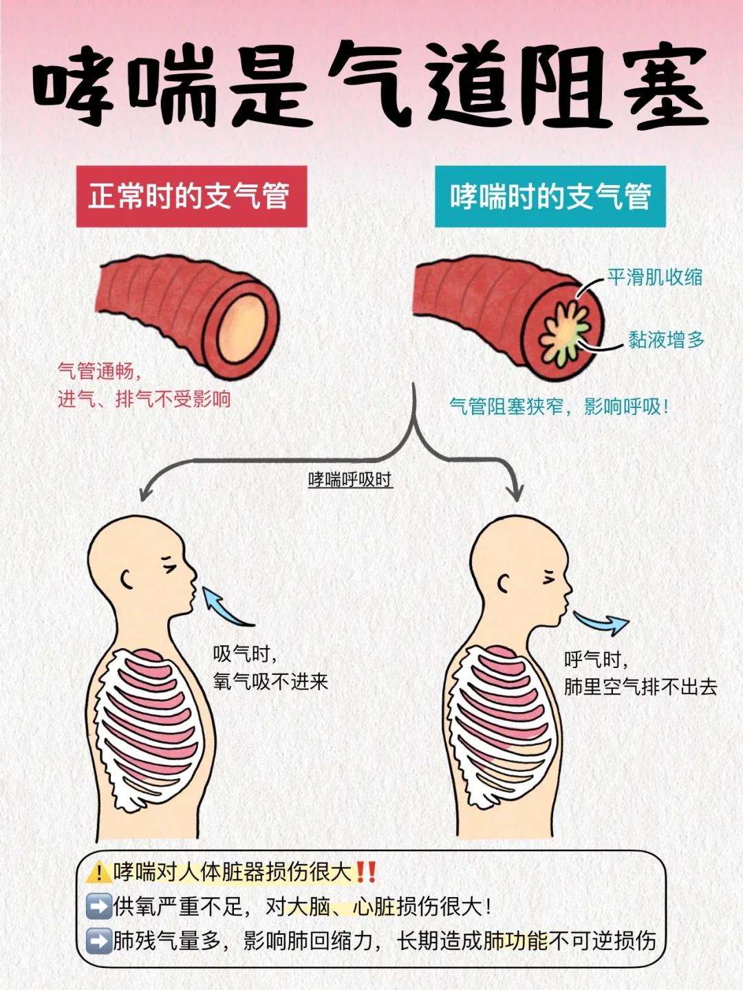 哮喘星人别焦虑！快去补肺，事半功倍！