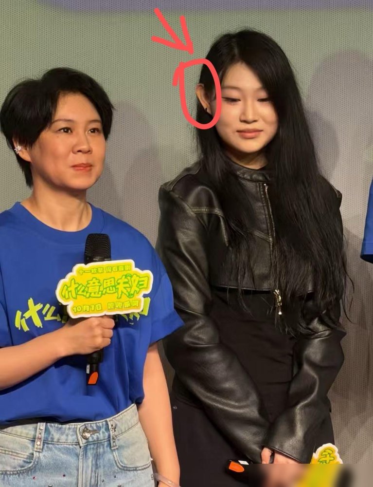 《什么意思夫妇》路演现场回来之后说了一句大实话，她说，之前在电视上真看不出来，但是线下一眼就能发现，沈佳润的面相真的很舒服 ！
当年带孩子上亲子综艺，小沈阳曾面对满屏容貌攻击在镜头前掉眼泪，悔得直说不该带女儿露面。
可十多年过去，这姑娘在异国练舞摔到骨折也能平稳应对，转头就回沈阳给母亲沈春阳的电