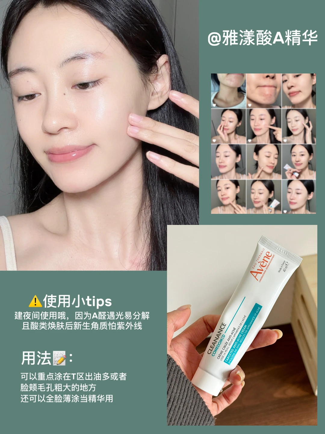 空瓶两支才敢发言：雅漾酸A堪比毛孔橡皮擦