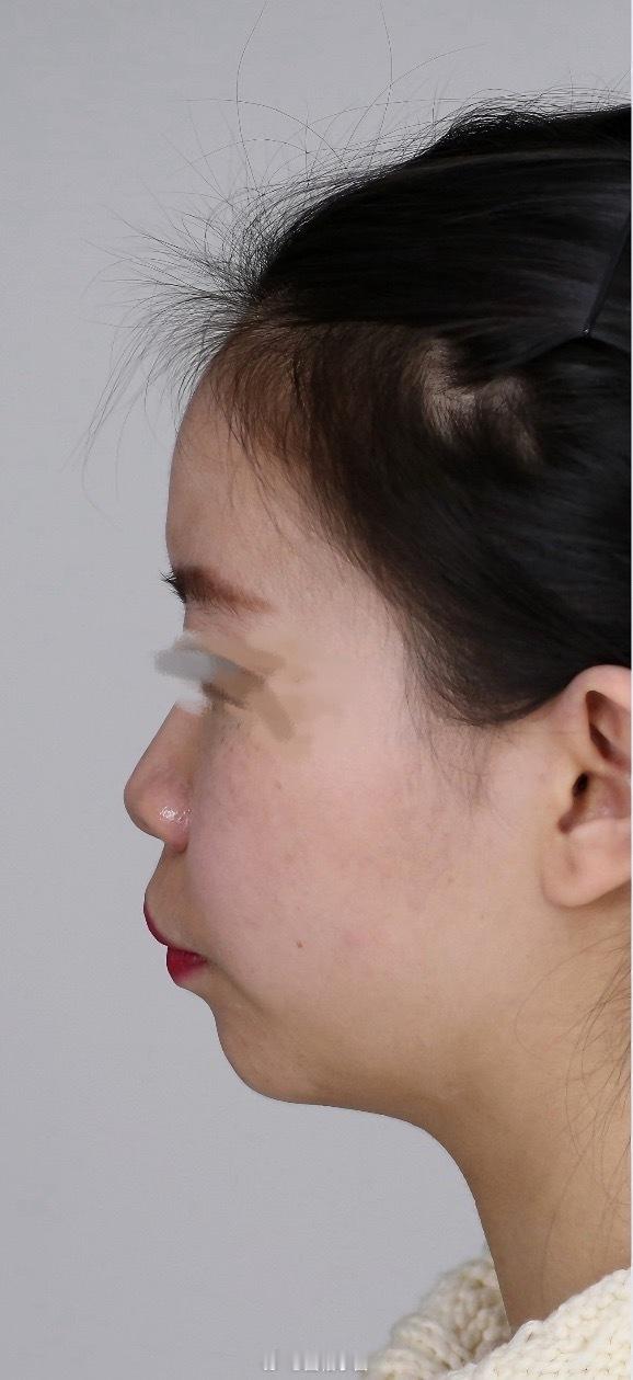 五官太平看似没有发育好，轮廓很不清晰，看着让人非常不舒服。这种人从小自卑，通常带着非常强烈的自证和向外攻击倾向。 ​​​