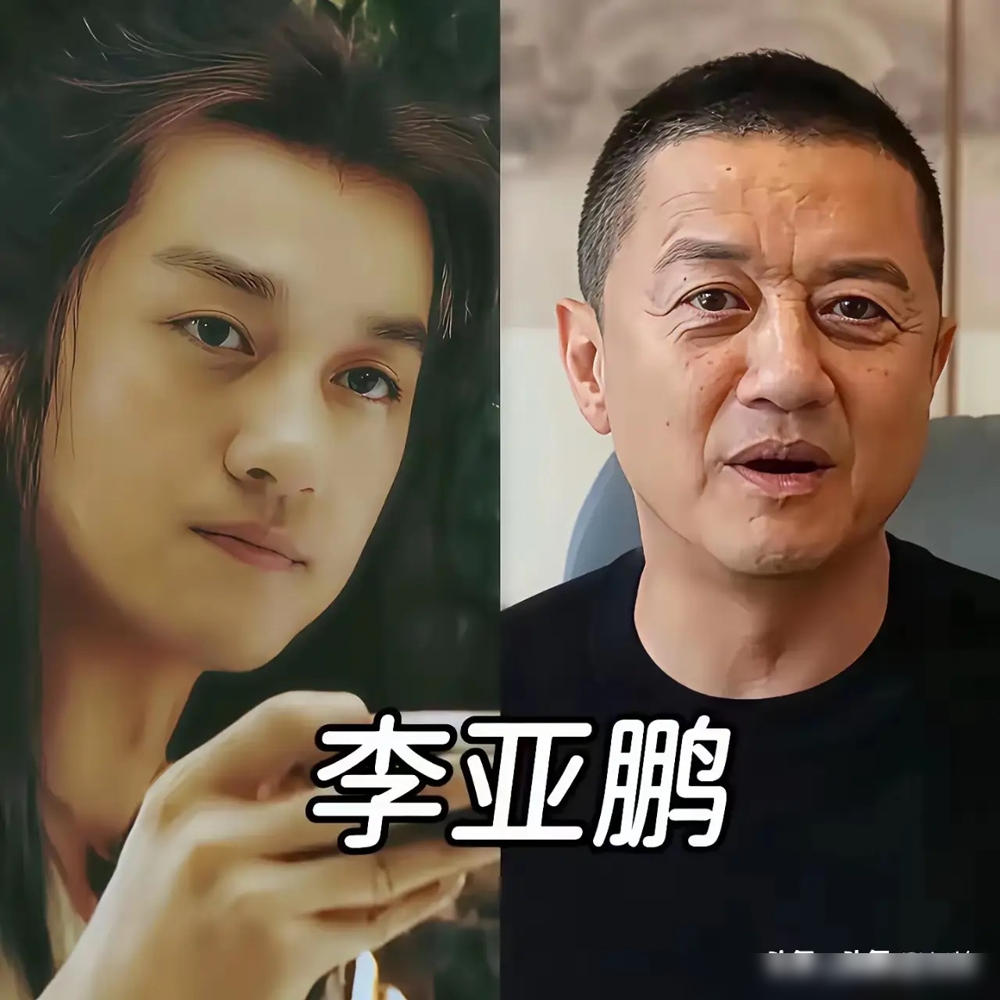 孙俪的脸又被顶上热搜，评论区清一色在喊甲亢脸。眼凸、发腮、脖子粗，网友拿着放大镜追了四年，从《安家》骂到《蛮好的人生》。
她还真去查了。医生朋友一句话怼回来：你眼睛又不是第一天大，从小就大。抽血化验，甲亢没有，病没有。
孙俪自己说，当年拼到免疫系统崩了，频繁住院、满脸爆痘，才逼着自己泡脚、食补、