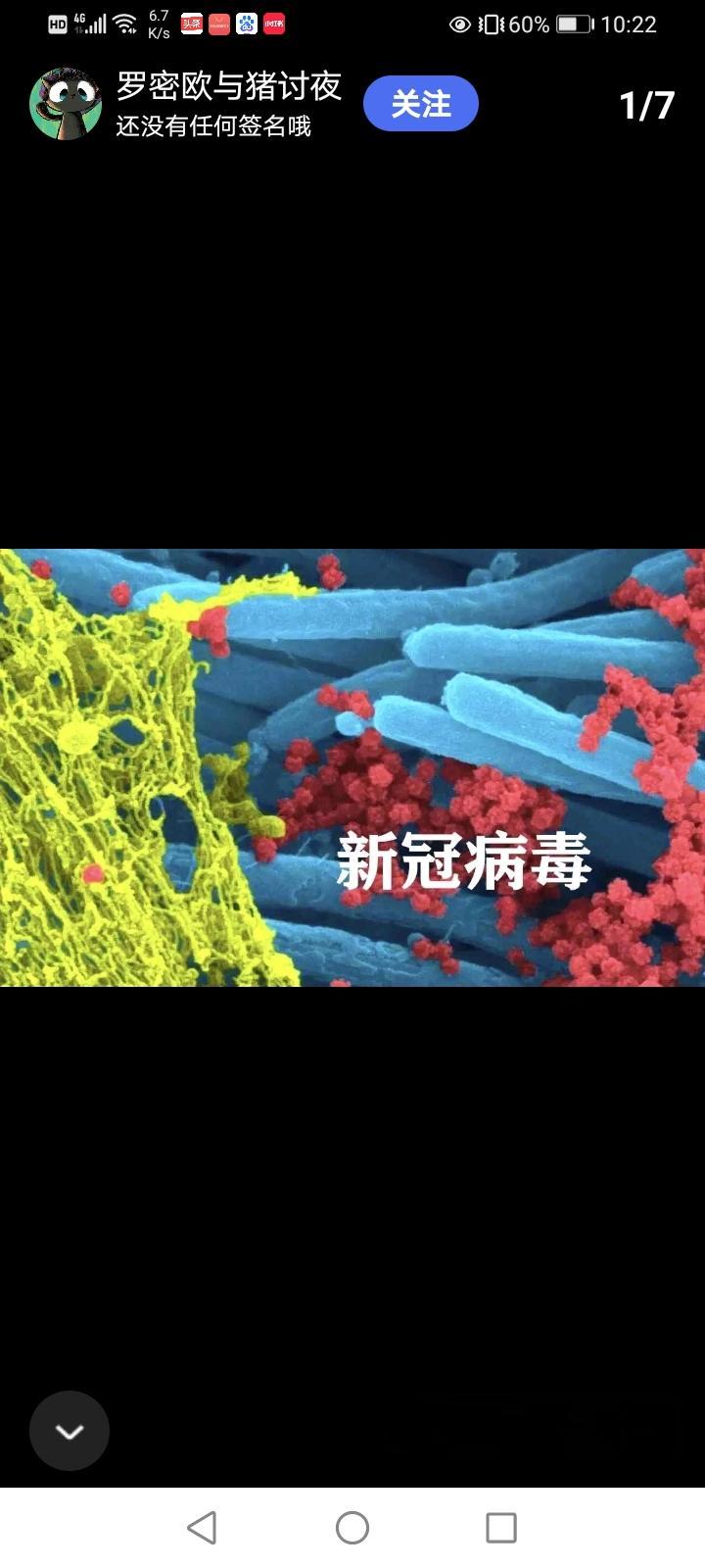 前天我兄弟跟我说，他感染新冠病毒了，好难受，我问他好好的为什么感染新冠病毒了？，他说陪他老婆去医院看病，结果被感染了，感染过新冠病毒的人，都知道得了新冠就像死过一次的难受，这新冠病毒感觉太诡异了，好像说谁都不能幸免遇难，疫情期间许多人感染了，也有许多人没被感染，这些没被感染新冠的人好像很幸运，惹得许