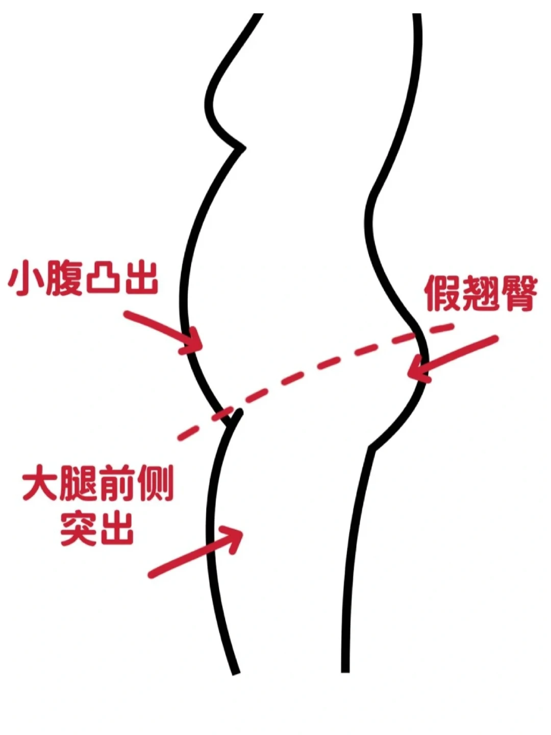 这种体态怎么办！这几个动作练起来！