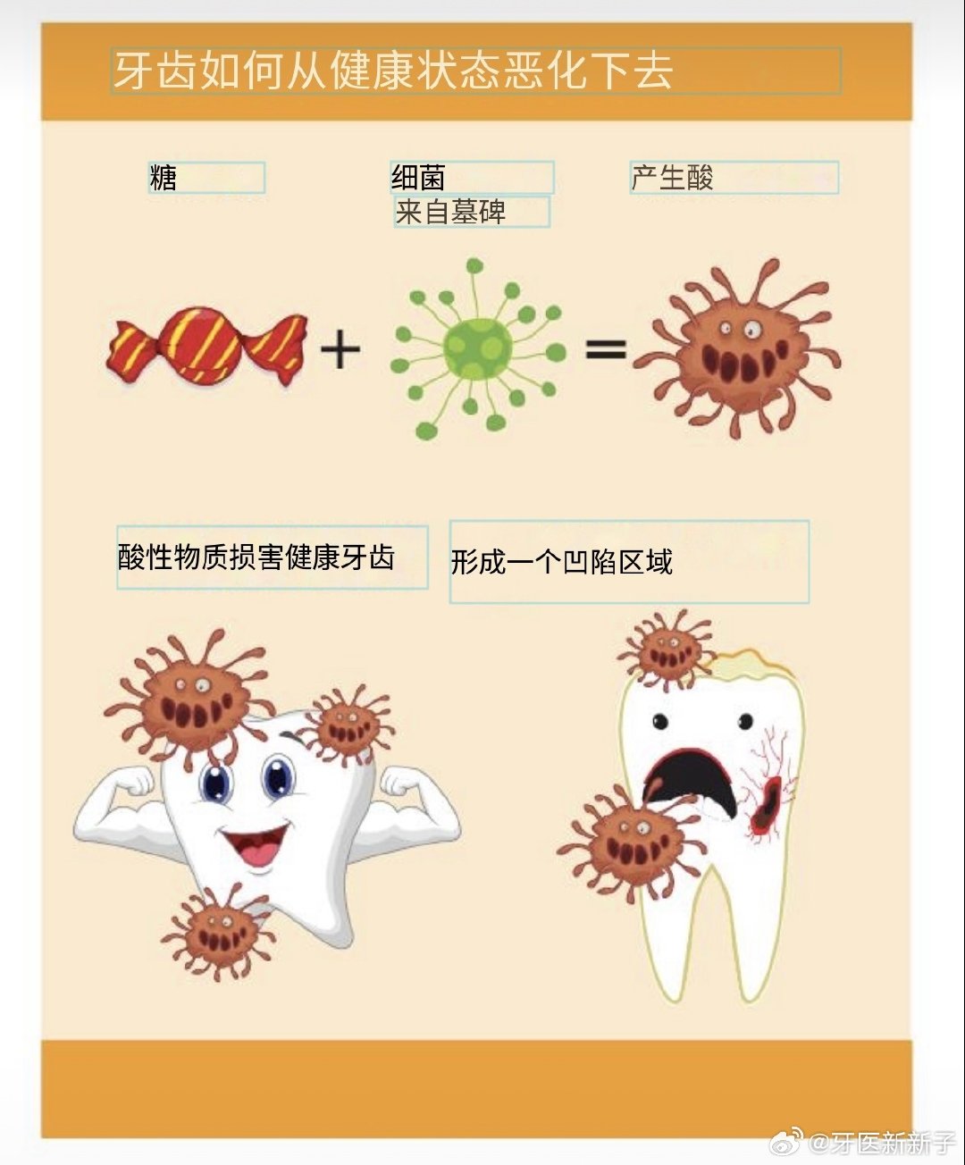 蛀牙，其实是牙齿长期输给了“酸”！
#白岩松谈儿童蛀牙危害# #白岩松对话舒客宝贝谈儿童防蛀# #全国爱牙日#
很多人以为，蛀牙就是“牙齿被细菌吃坏了”。

其实并不完全准确。

真正直接破坏牙齿的，是酸。

我们每次吃东西，尤其是吃糖、甜点、喝奶茶和含糖饮料以后，口腔里的菌斑细菌就会利用这些糖分进行代谢，并产生酸。

这些酸会让牙齿表面的酸碱度下降。

当酸性环境达到一定程度，牙釉质中的钙、磷等矿物质就会逐渐溶解，这个过程叫做脱矿。

而我们的牙齿并不是完全被动的。

唾液本身就具有缓冲和清洁作用，同时能够提供钙、磷等物质，帮助牙齿进行再矿化。

所以，正常情况下，牙齿每天都在经历：

脱矿 → 再矿化 → 脱矿 → 再矿化。

真正的问题在于：

如果我们一天到晚不停地吃甜食、喝含糖饮料，牙齿就会反复进入酸性环境。

脱矿的时间越来越长，再矿化的机会越来越少。

久而久之，牙齿就可能从最开始的轻微脱矿，发展成白垩色斑、牙釉质缺损，最终形成我们看到的——龋洞。

所以，预防蛀牙真...