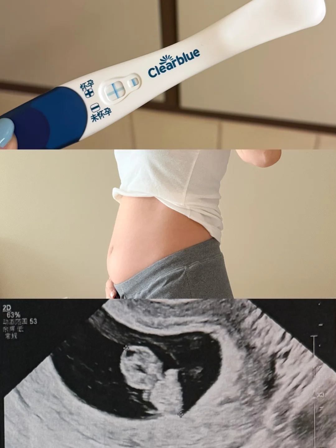 迎接我的小天使👼