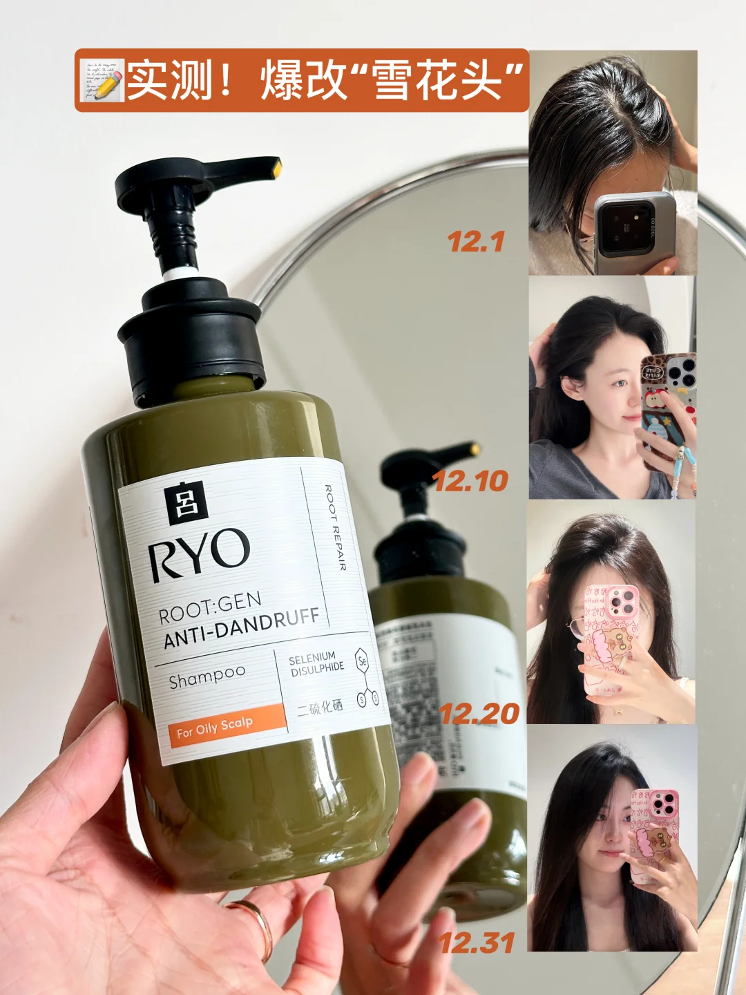 实测打卡！去屑橙标用完半瓶，头屑清空