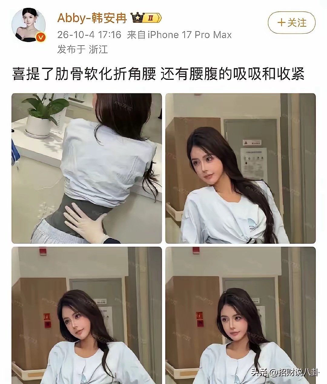 韩安冉又作妖了，她把肋骨软化了，做出这种折角腰，腰只有巴掌大，却连健康都不要了。
​任何东西都有它存在的道理，韩安冉这种为了美不顾身体健康，太极端了。 ​
