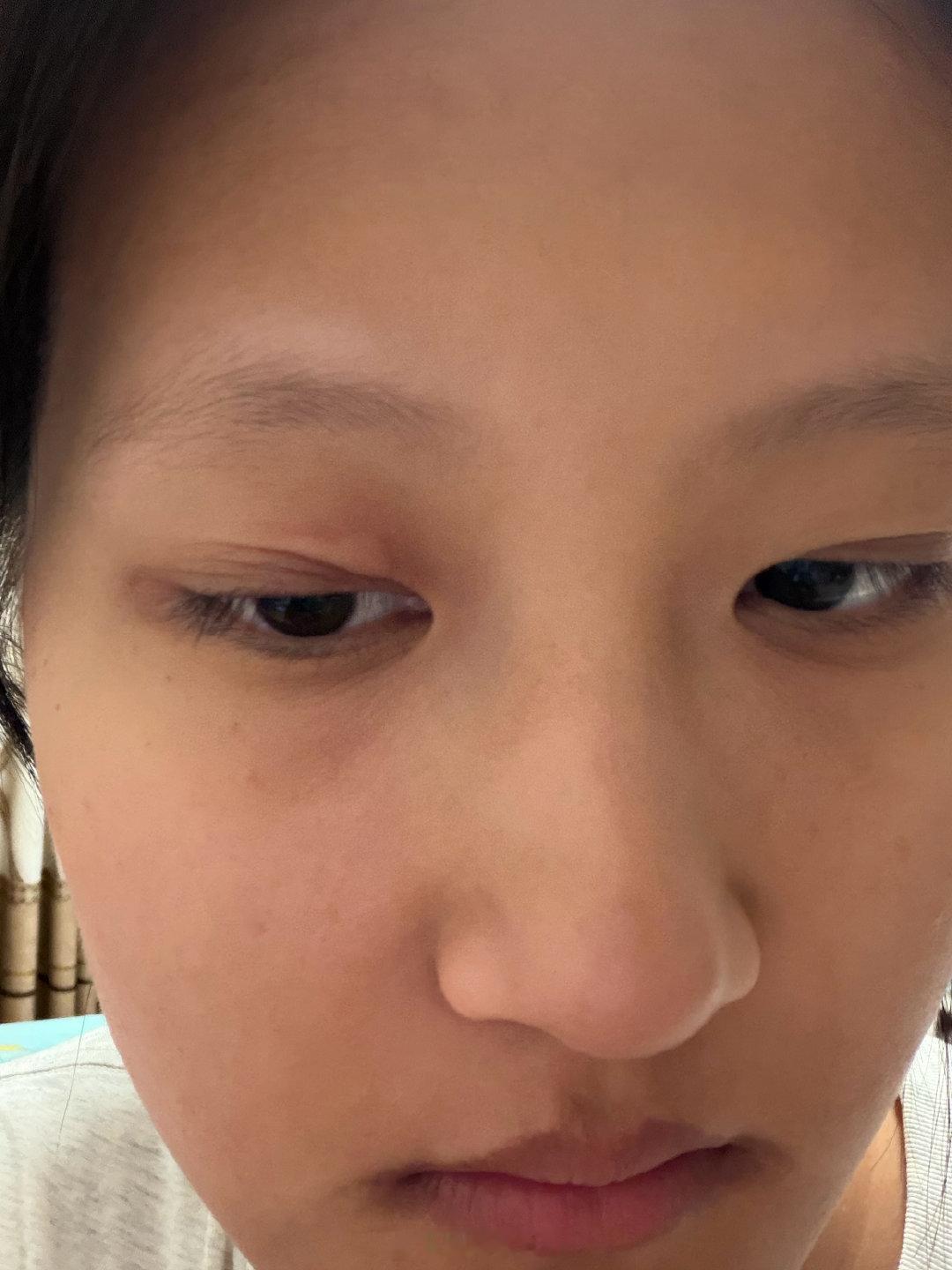 老天爷我没杀人没犯法吧 一到换季就开始了 我招谁惹谁了 ​