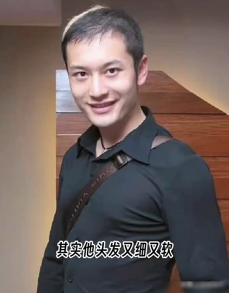 张卫健拍完戏直接光头了，毛囊全烂，一根都长不出来。
黄晓明更惨，早年《神雕侠侣》天天闷头套里，胶水往头皮上糊。现在私下被拍到，头顶稀疏得见光，上台全靠半罩假发片硬撑。
郑少秋32岁就秃了，清装戏剃头加胶水，发根活活烧死。陈豪也骂过，赶戏压力一大，头发一把一把掉。
周渝民拍《烈火如歌》，两边鬓角