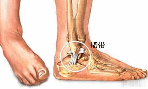 【 “内翻性损伤”主要是指受伤时脚踝向内翻转的动作，往往发生在迅速改变...