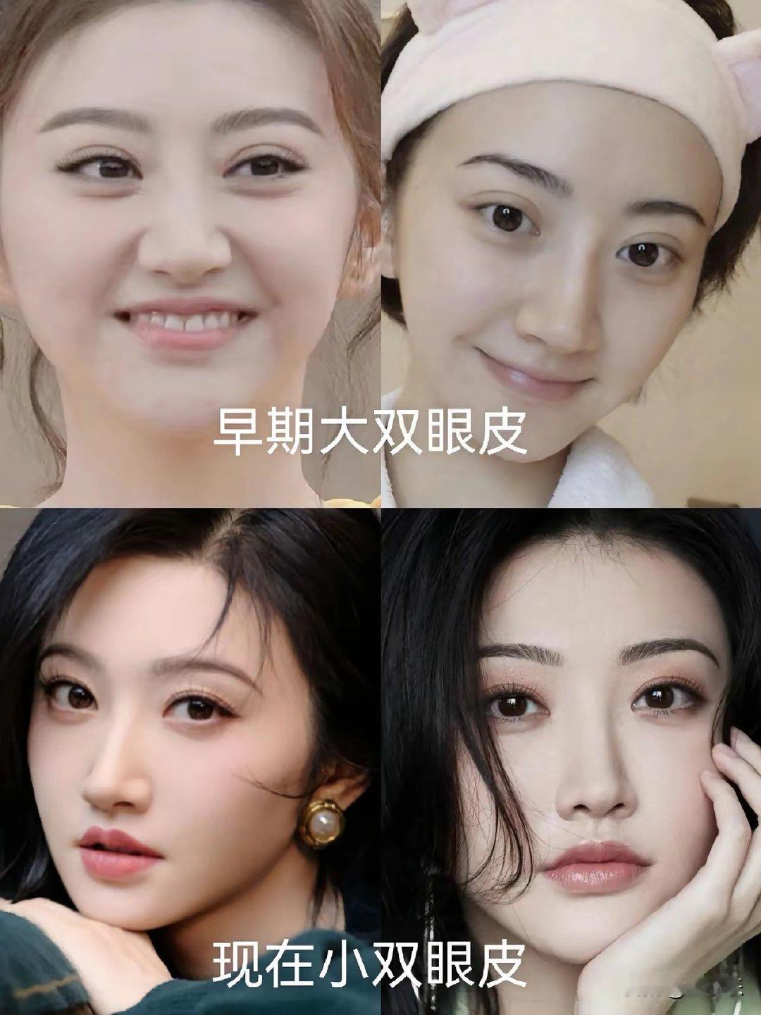 景甜早期伤心蛙的大双眼皮真心不好看，还好后面调回来了！ ​