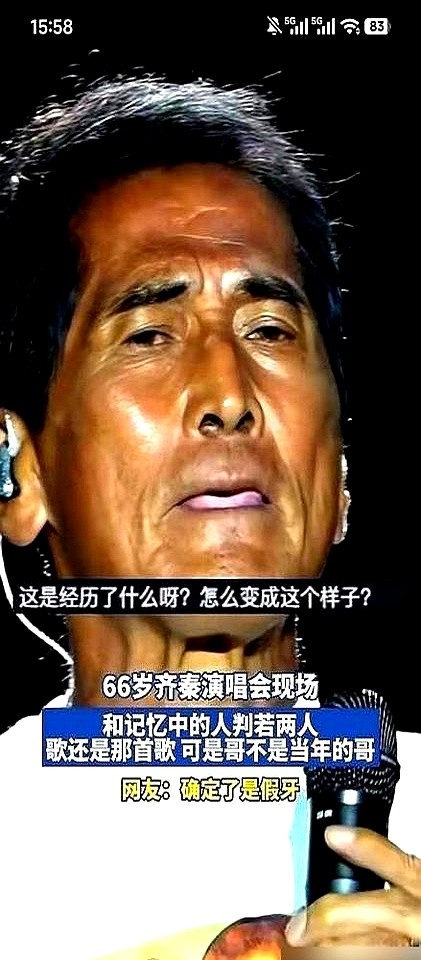 在美国折腾一年植了24颗牙，人瘦到脱相，64岁的齐秦转头就开了北美巡演。

拉斯维加斯、大西洋城一场没落。现场嗓子沙哑，高音实在拔不上去，唱到《夜夜夜夜》干脆把话筒递向台下，靠全场大合唱撑过去。

有人骂他吃相难看靠情怀圈钱，可也有人替他说话：这把岁数全程全开麦，至少没放伴奏糊弄人。

争议归争议，