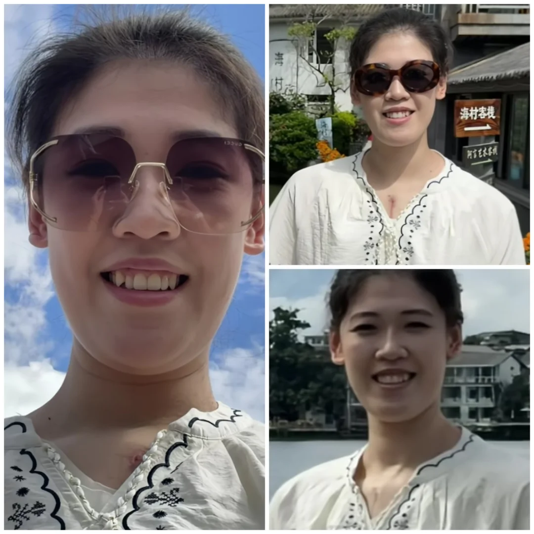 李盈莹胸口伤疤触目惊心，建议别再从事运动