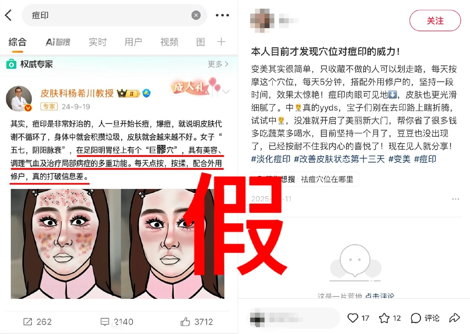 #杨希川辟谣专帖# 本人目前还未发现穴位对痘印的威力[裂开] ​