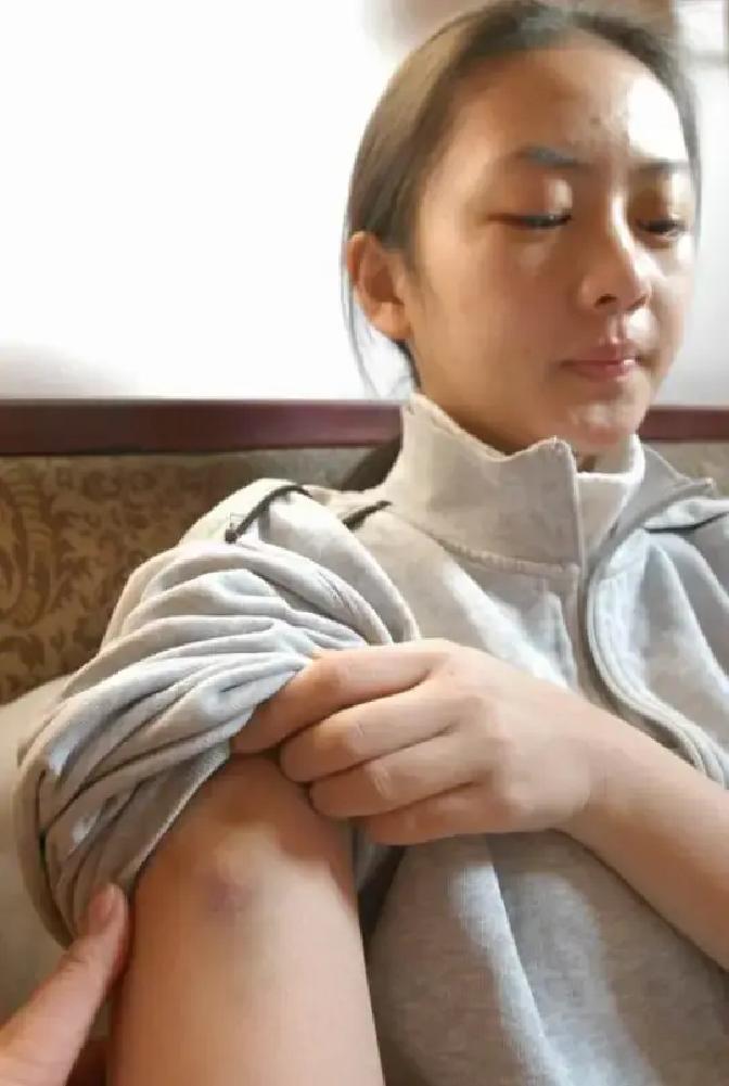 2003年，张国立的儿子张默，在中戏门口殴打女友童瑶，18岁的童谣被打到跪地求饶：“歇10分钟再打吧！让我缓缓行吗？”没想到，张默接下来的举动，让她至今无法原谅。

童瑶蜷缩在地上，视线因为疼痛和泪水一片模糊。她能感觉到鼻子火辣辣地疼，温热的血不断往外冒，嘴里也是腥咸的味道。张默的脚印还清晰地留在她