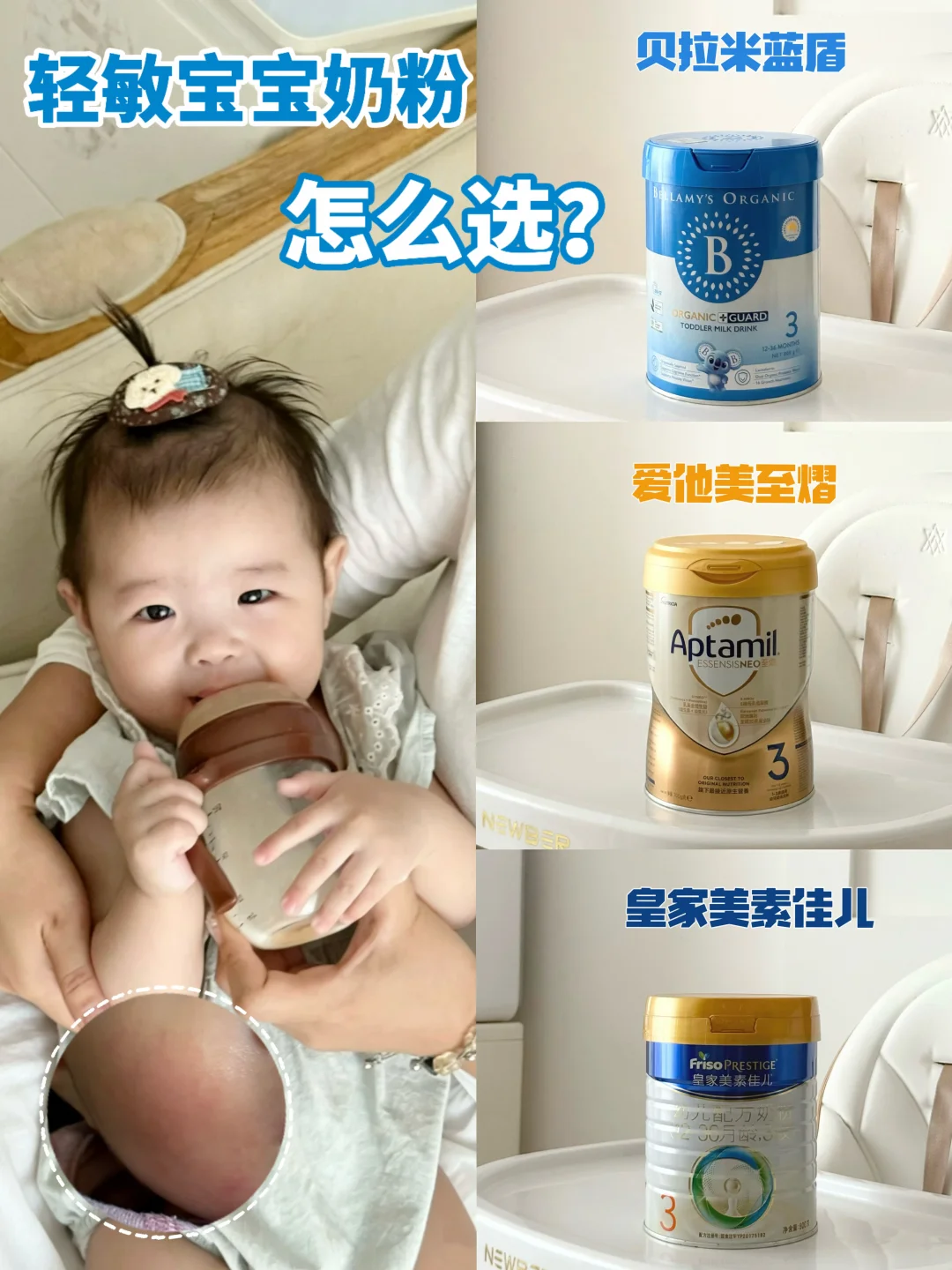 宝宝肚肚娇嫩爱泛红？三款防敏奶粉真实横测