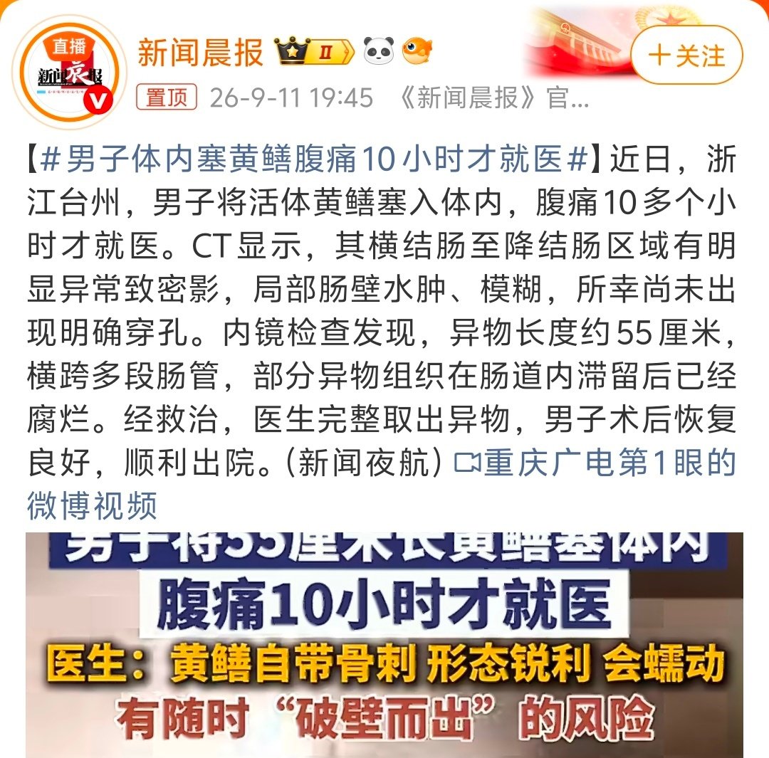 #男子体内塞黄鳝腹痛10小时才就医#
菊花超市…… ​