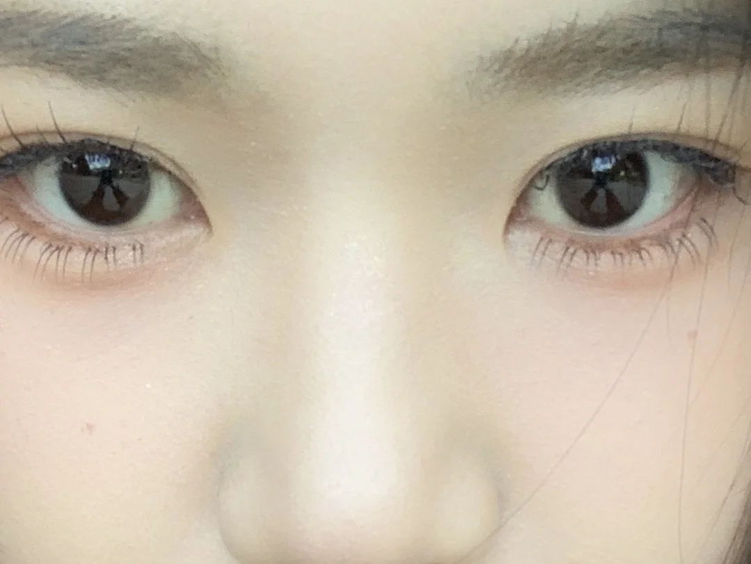 韩国买的泪沟支撑剂好用死了啊啊啊啊啊啊啊