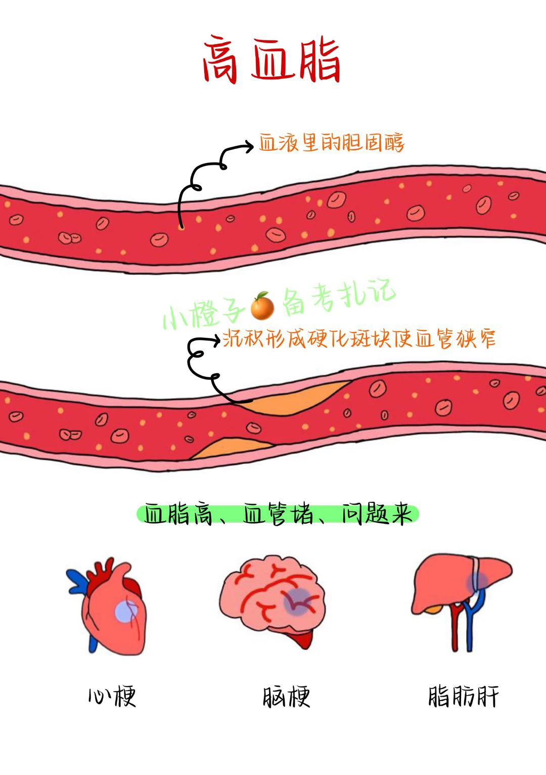 胆固醇🔝高血脂⚠️宝藏级干货请收藏✅